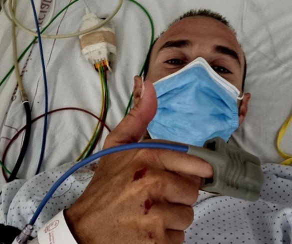Atropellado Alejandro Valverde: “No ha sido un accidente”